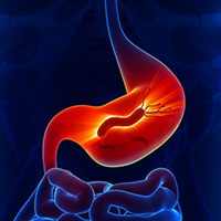 h-pylori