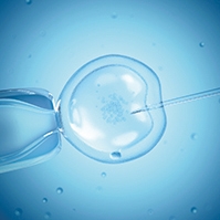 IVF