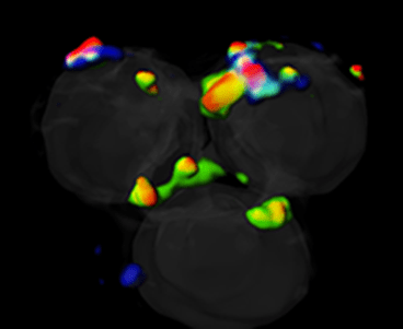 Feature image | Three blood cells from a healthy volunteer that are photographed using super-resolution microscopy. This state-of-the-art technology allows us to see individual proteins of IL-37 (in green) and the components of its cell surface receptor, IL-1R8 in blue and IL-18Ralpha in red.