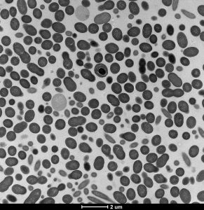 Bacterial isolate from a novel genus of the Lachnospiraceae family cultured in the study. Photo: David Gould, Wellcome Trust Sanger Institute