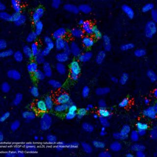 VEFG H LDL EPC Culture Bright-2