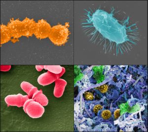 Image of gut microbiome and cancer