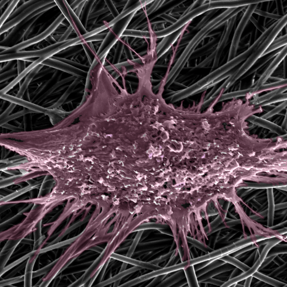 One single endometrial mesenchymal stem cell attaches and interacts with nanofibres at nanoscale