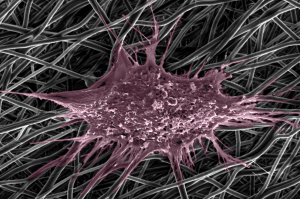 One single endometrial mesenchymal stem cell attaches to and interacts with nanofibres at nanoscale.