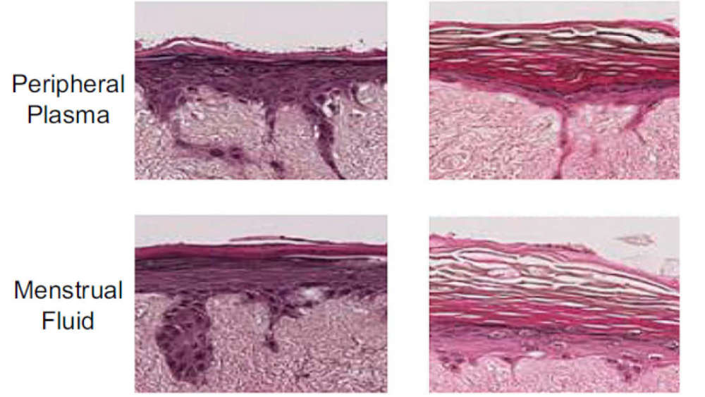 Menstrual Fluid close up