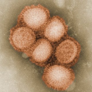 Morphology of the swine flu virus.