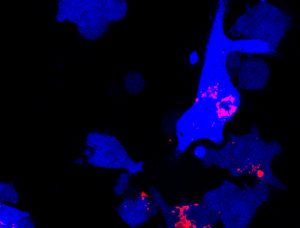 COVID-19 has similar characteristics to Influenza A virus (IAV), including damaging lung inflammation. Here macrophages engulf an IAV peptide that induces inflammation. Activated cells are identified in bright blue.