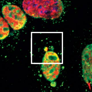 The nuclei of mouse fibroblasts treated with a low dose of a chemotherapy drug for 2 days. The vesicles contain damaged DNA (revealed by the green and red overlay).