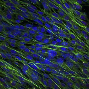 Osteosarcoma cells stained for acetylated tubulin (green) and ARL13B (red), markers that are co-expressed by a cellular organelle called a primary cilia. The primary cilia are required for the Hedgehog signalling pathway.