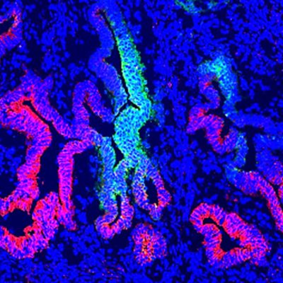 Human endometrial epithelial progenitor cells