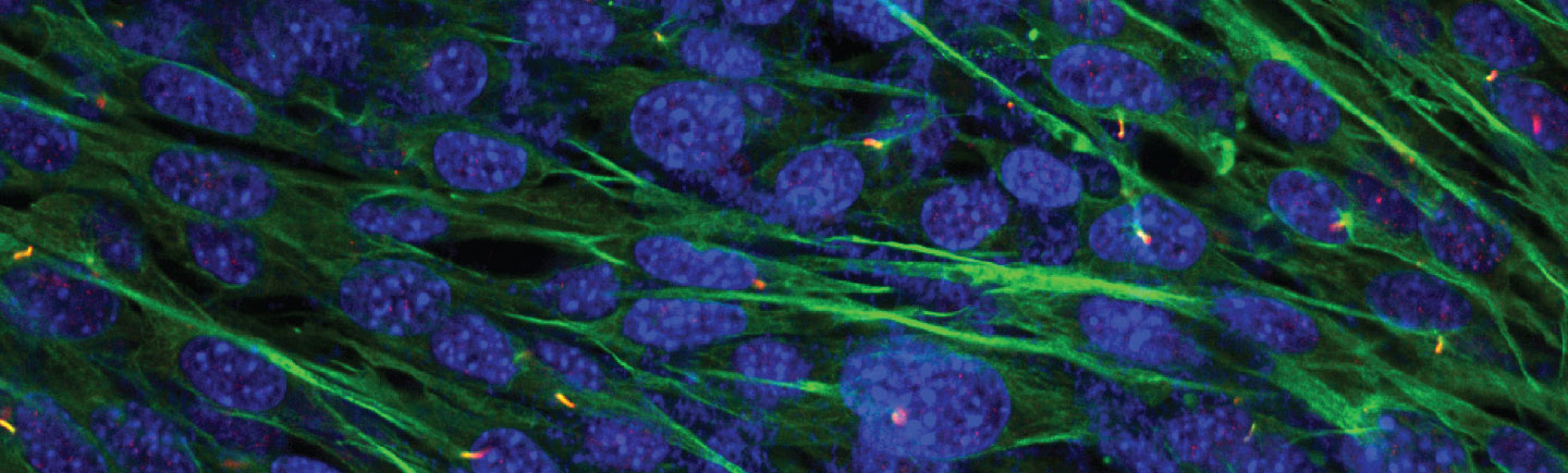 Cell image: Osteosarcoma cells stained for acetylated tubulin (green) and ARL13B (red), markers that are co-expressed by a cellular organelle called a primary cilia. The primary cilia are required for the Hedgehog signalling pathway.
