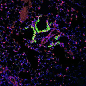 A/Prof Rebecca Lim's cell image showing confocal fluorescence microscopy of fibrotic mouse lungs.