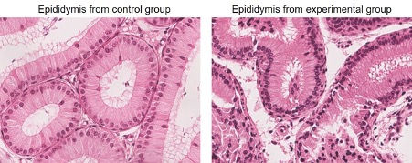 Cell images shows microscopic analysis of epididymis.