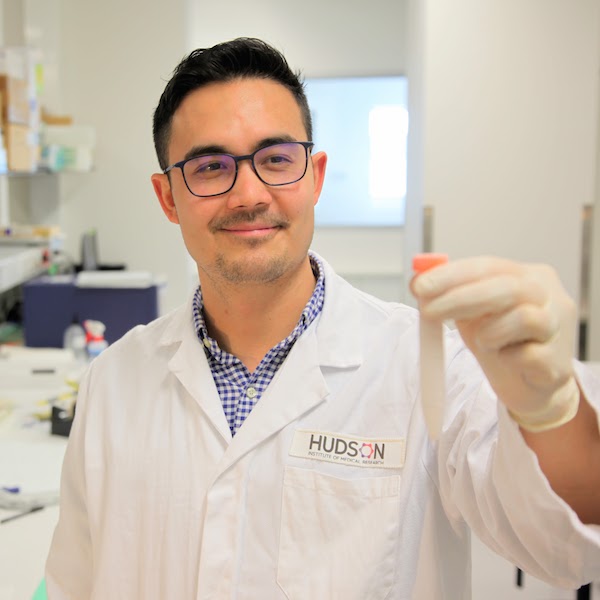 Dr Lindsay Zhou and researchers at Hudson Institute have reviewed all current research into umbilical cord blood stem cells treatment, which offers hope to premature babies.