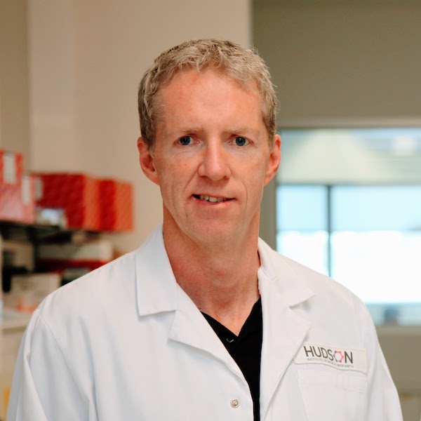 Professor Brendan Jenkins works on being able to turn off the actions of the immune system that damage the lungs, opening up the possibility of slowing emphysema development.