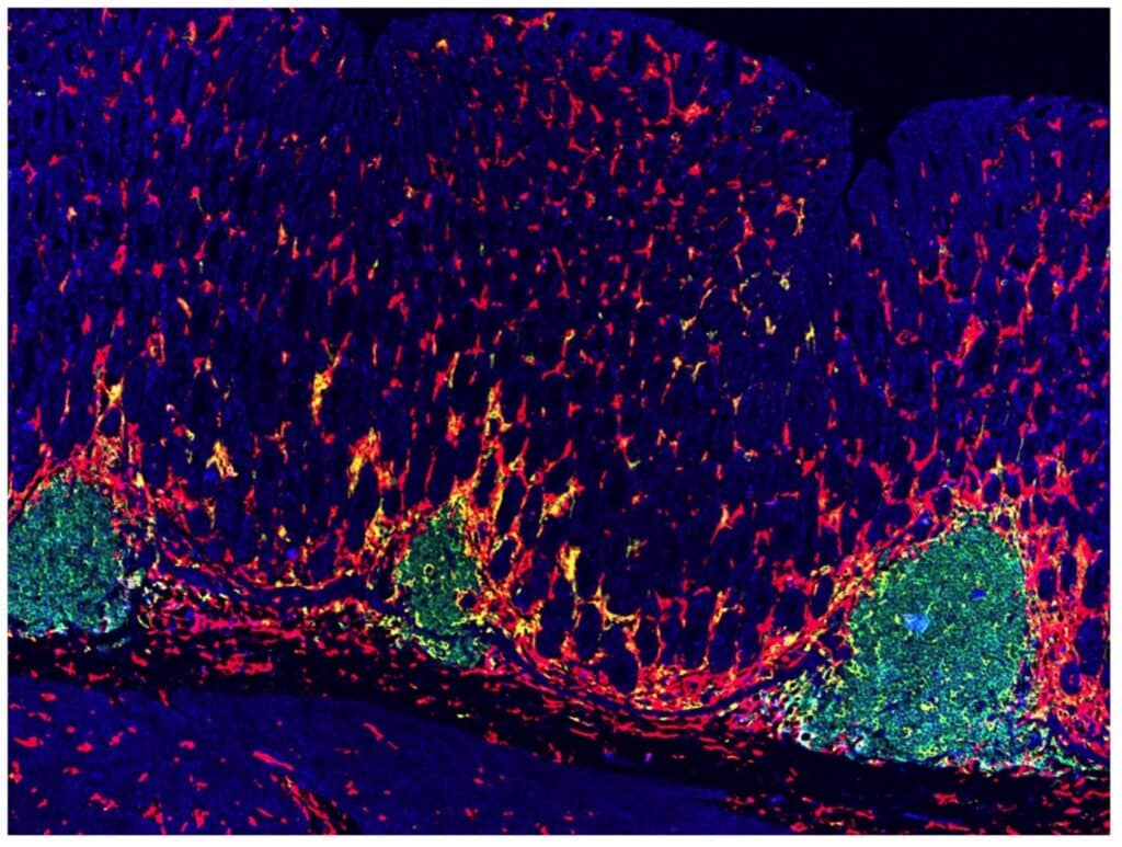 Image is of a tissue section from our pre-clinical model in which precancerous lesions of stomach lymphoma are seen to be predominantly composed of B cells (green) and surrounded by different types of immune cells (red, yellow). Image provided by Dr Ying.