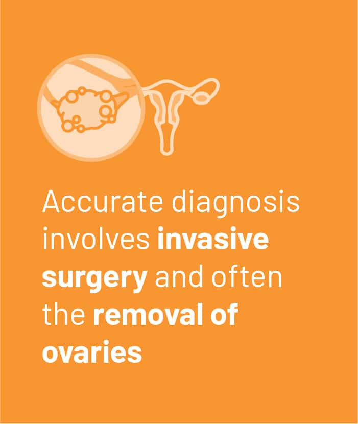 Accurate diagnosis involves invasive surgery and often the removal of ovaries
