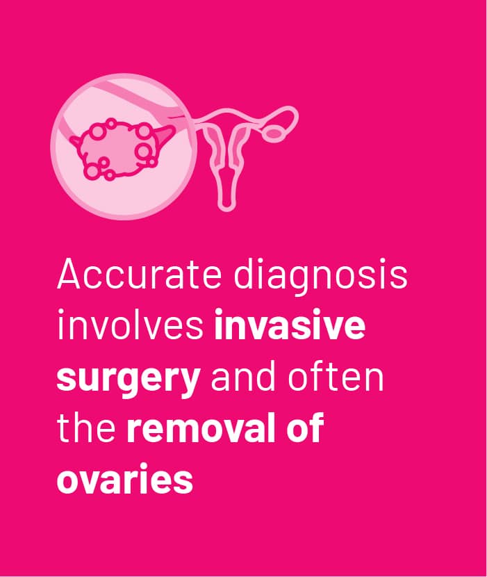 Accurate diagnosis involves invasive surgery and often the removal of ovaries