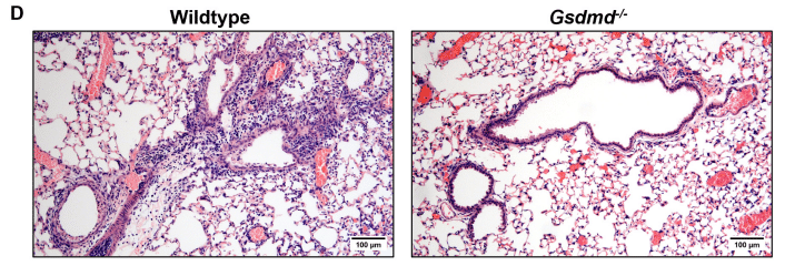 Fatal influenza  this cell image shows that in the absence of GSDMD, lung inflammation and damage is reduce