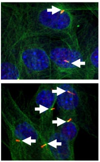 Osteosarcoma cells expressing a cellular structure called a primary cilia (arrows)