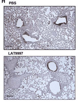 LAT9997 treatment during severe influenza virus infection limits lung damage and cell death