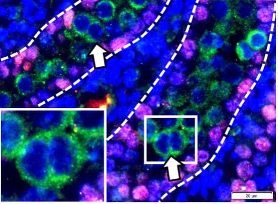 Fluorescent image showing multinucleated germ cell (arrows and inset)