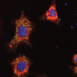Interaction between STAT3 and SLIRP blue dye shows the cell nucleus