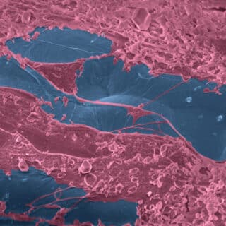 POP | Images showing cellular expression on 3D printed degradable pelvic meshes